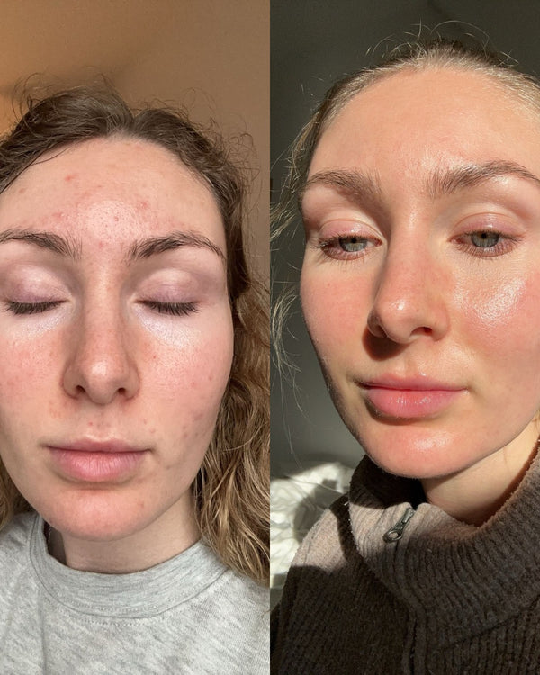 Seen on #PoulBeauty
