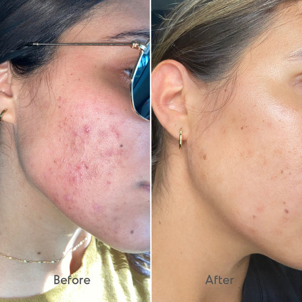 Seen on #PoulBeauty
