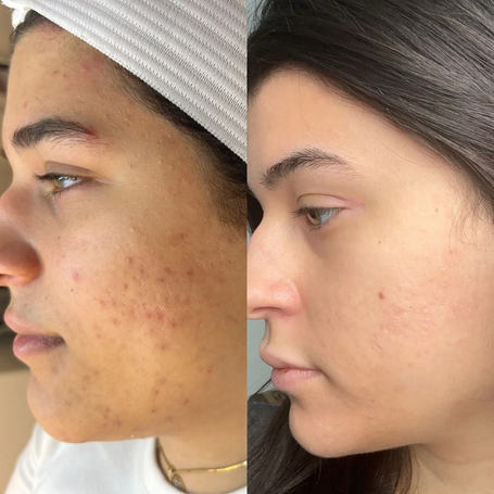 Seen on #PoulBeauty