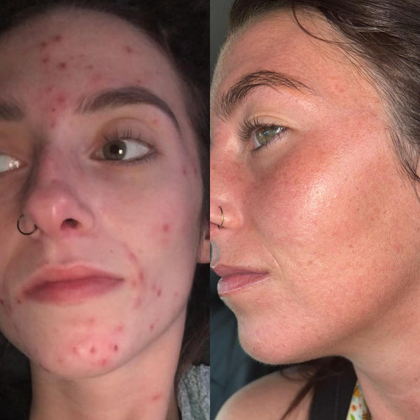 Seen on #PoulBeauty