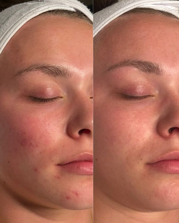 Seen on #PoulBeauty